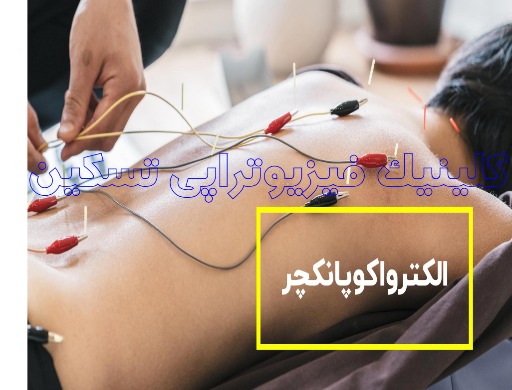 الکترو آکوپانچر/فیزیوتراپی تسکین /کلینیک ایلام